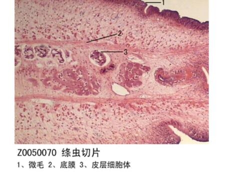 甘肃绦虫切片