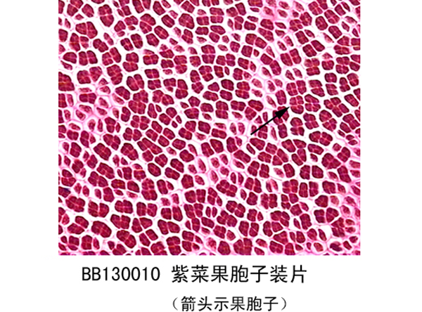 黑龙江紫菜果胞子装片