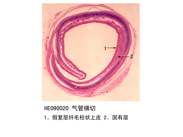 山西​气管横切