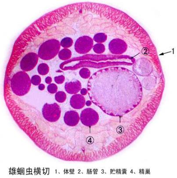 新乡雄蛔虫横切