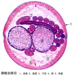 新乡雌蛔虫横切