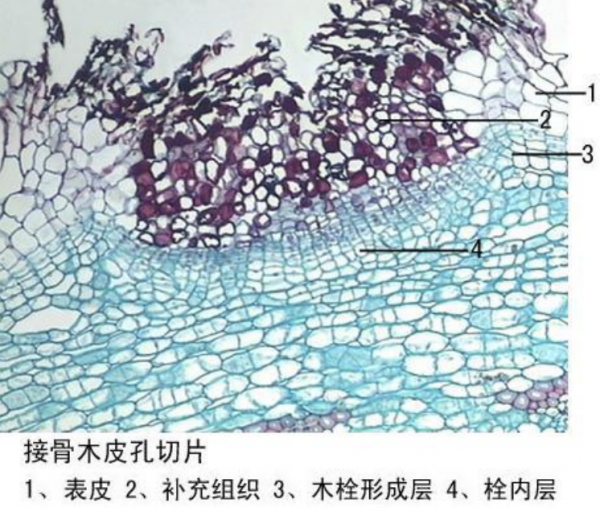 济源接骨木皮孔切片