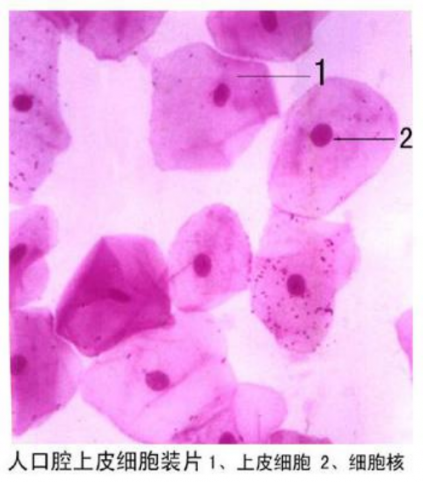 泸州人口腔上皮细胞装片