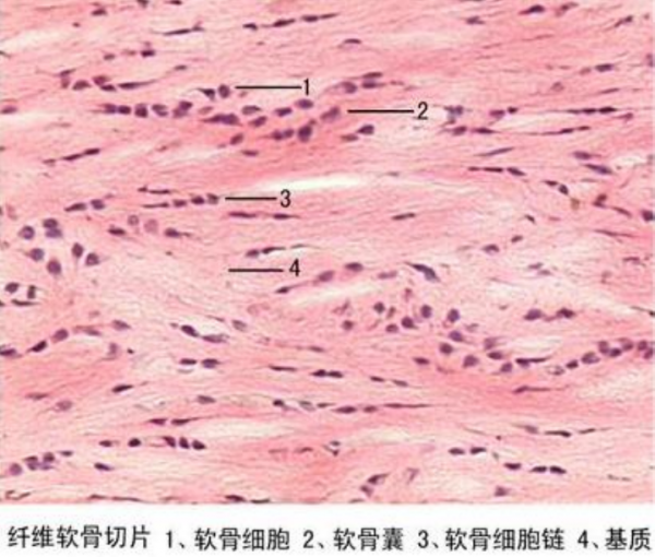 黑龙江纤维软骨切片