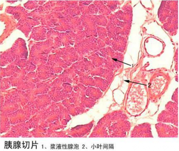 黑龙江胰腺切片