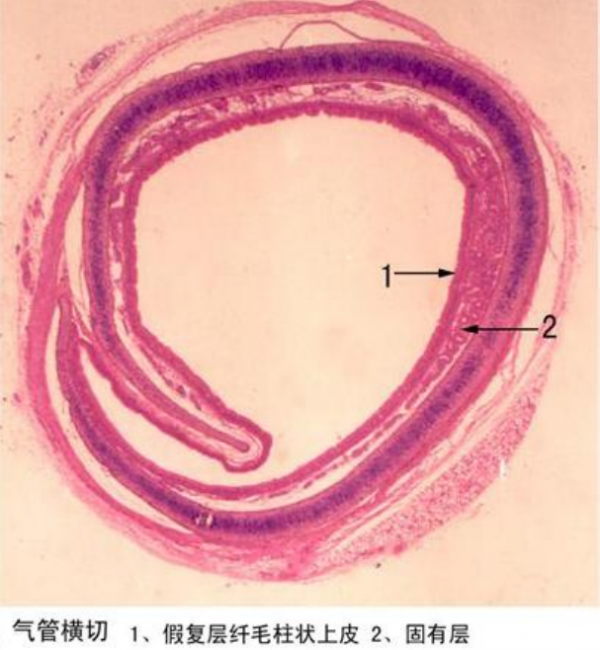 河南气管横切