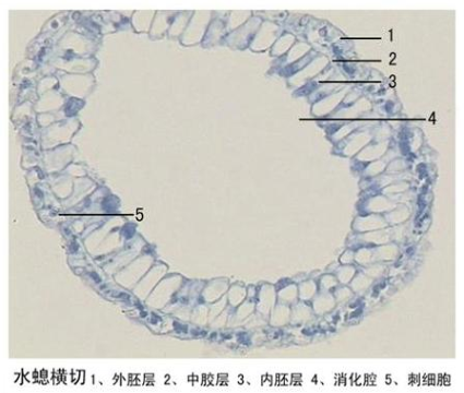 鹤壁水螅横切