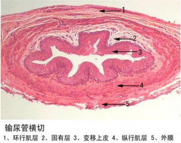 恩施输尿管横切