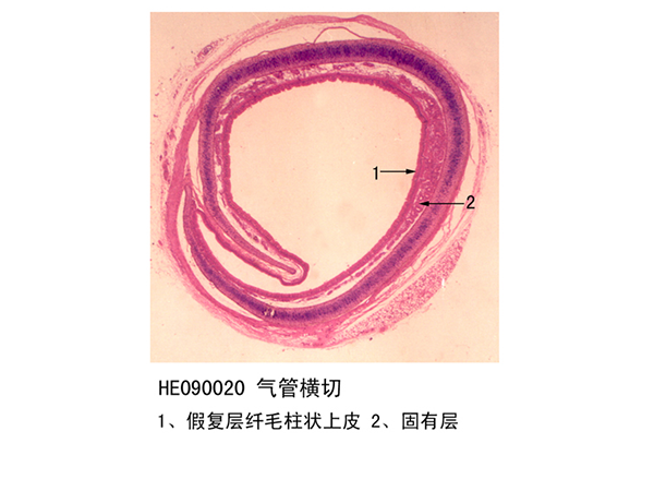 气管横切