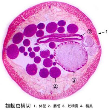 雄蛔虫横切