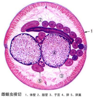 雌蛔虫横切