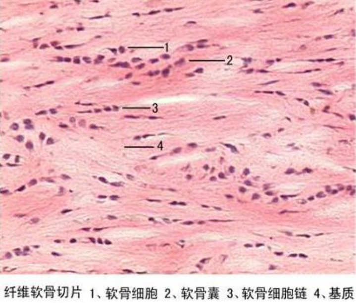 纤维软骨切片