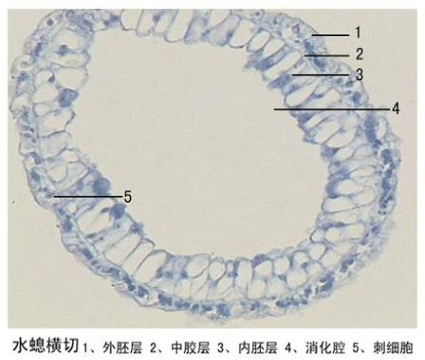 水螅横切