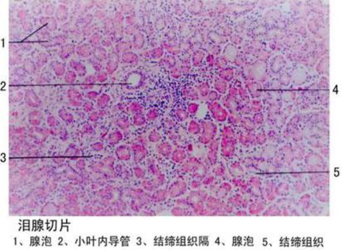 泪腺切片